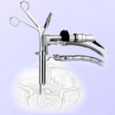 山东冠龙 经皮穿刺椎间盘镜手术系统