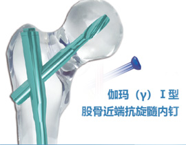 康盛伽玛I型股骨近端抗旋髓内钉